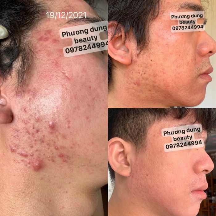 Hình ảnh không gian dịch vụ chuyên nghiệp tại Phương Dung Beauty