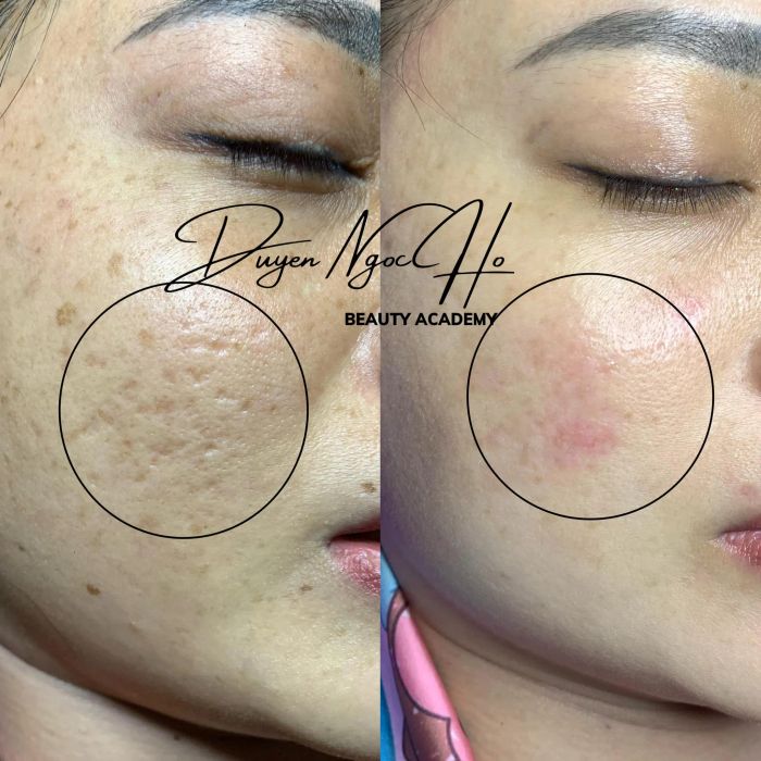 Hình ảnh quy trình trị liệu chuyên nghiệp tại Duyên Spa Mỹ Tho