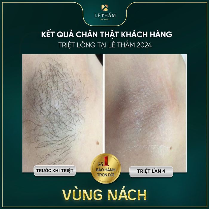 Không gian hiện đại tại LÊ THẮM Beauty – Thư giãn và trải nghiệm đẳng cấp