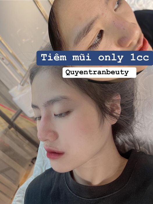 Quyên Trần Beauty – Không gian làm đẹp thanh lịch, tinh tế (ảnh 1)