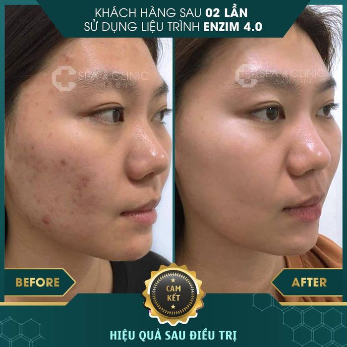 C Spa & Clinic - loạt ảnh ấn tượng về quy trình chăm sóc da chuyên nghiệp