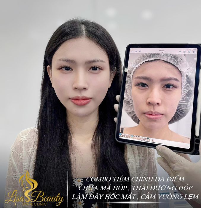 Không gian sang trọng và hiện đại tại Lisa Beauty Spa & Clinic