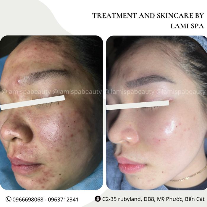 Hình ảnh thư giãn và làm đẹp tại Lami Spa - Beauty & Academy