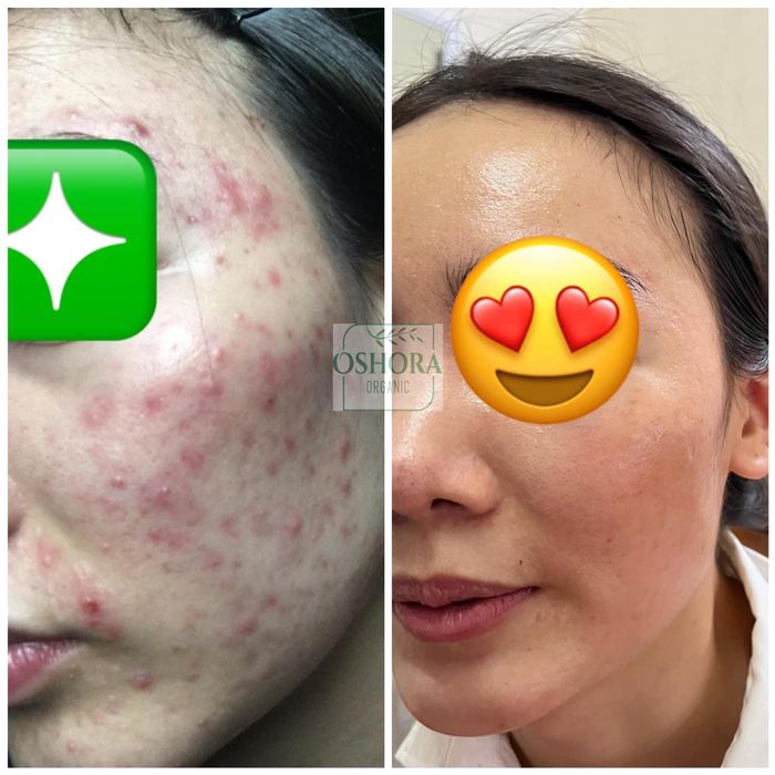 Hình ảnh Oshora Organic Clinic & Spa 2