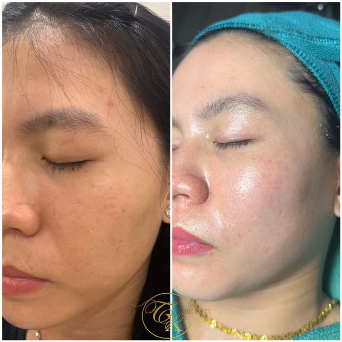 Hệ thống máy móc trị liệu hiện đại tại Thảo Cỏ Xanh - Cam kết chuẩn y khoa quốc tế