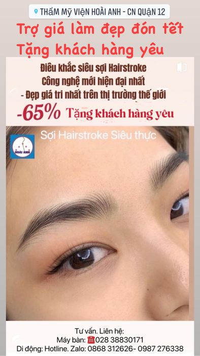 Hình ảnh thực tế về quy trình chăm sóc da chuyên nghiệp tại Thẩm Mỹ Viện Hoài Anh