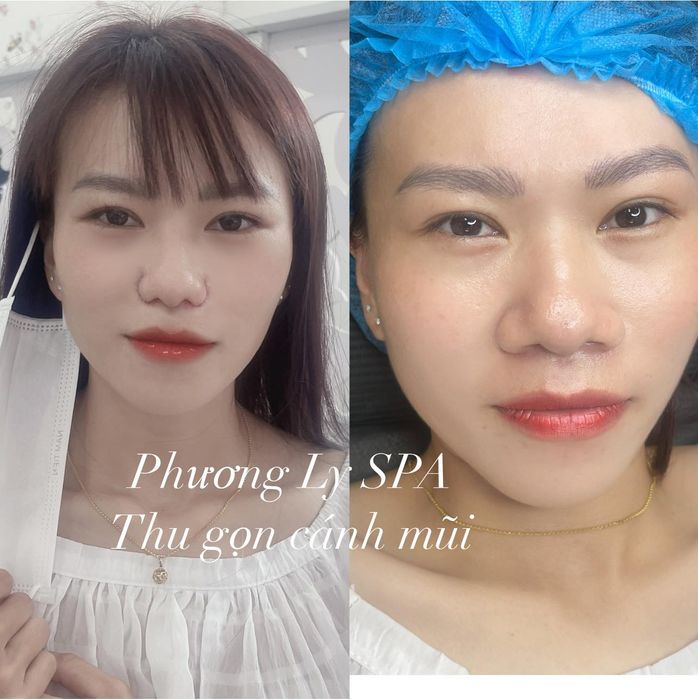 Phương Ly Beauty - Spa hình ảnh 3