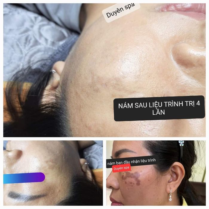 Ảnh Duyên Spa 1
