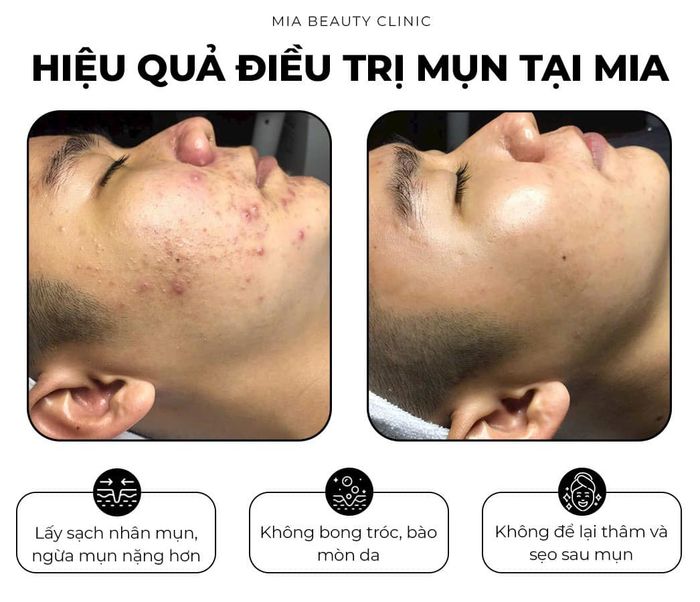 Bộ ảnh thực tế tại Mia Beauty Clinic - Phần 1