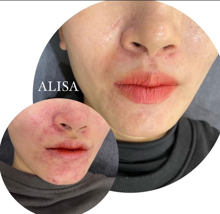 ALISA Beauty & Skincare – Không gian lý tưởng cho làn da thăng hoa (ảnh 2)