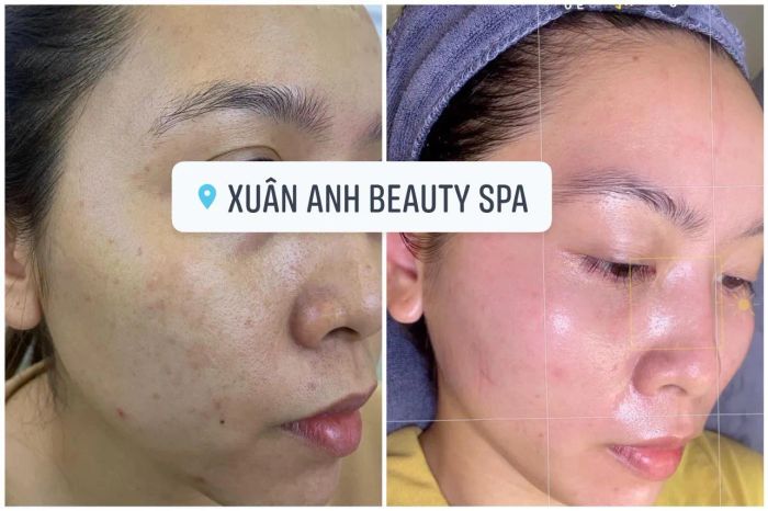 Không gian trị liệu sang trọng tại Xuân Anh Beauty Spa