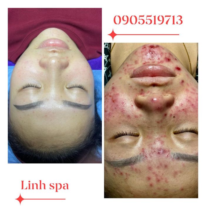 Hình ảnh quy trình chăm sóc da cao cấp tại Linh Spa