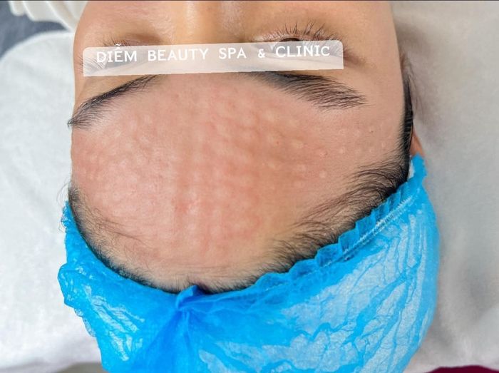 Diễm Beauty Spa – Không gian thư giãn tinh tế, nâng niu làn da bạn (ảnh 2)