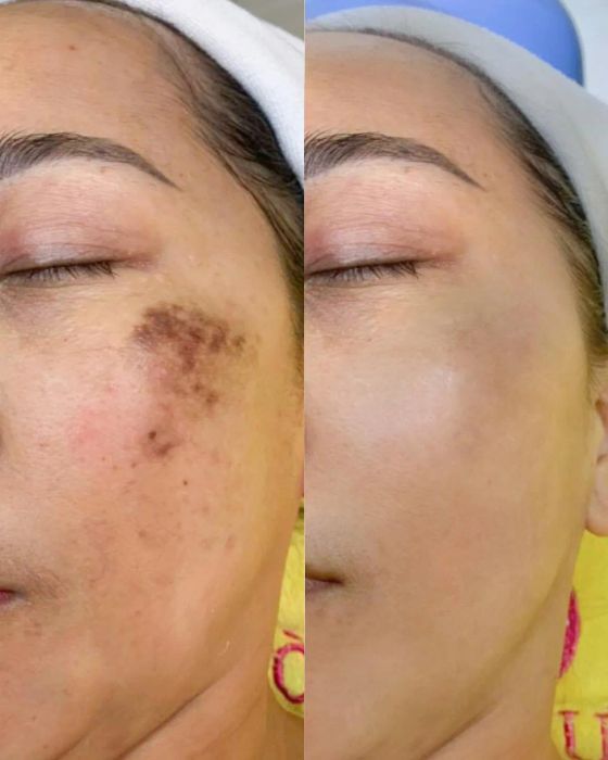 Hình ảnh quy trình thẩm mỹ chuẩn y khoa tại Ngọc Hường