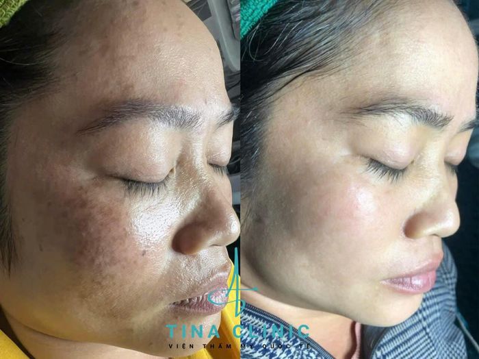 Ảnh Gia Hân Spa 2