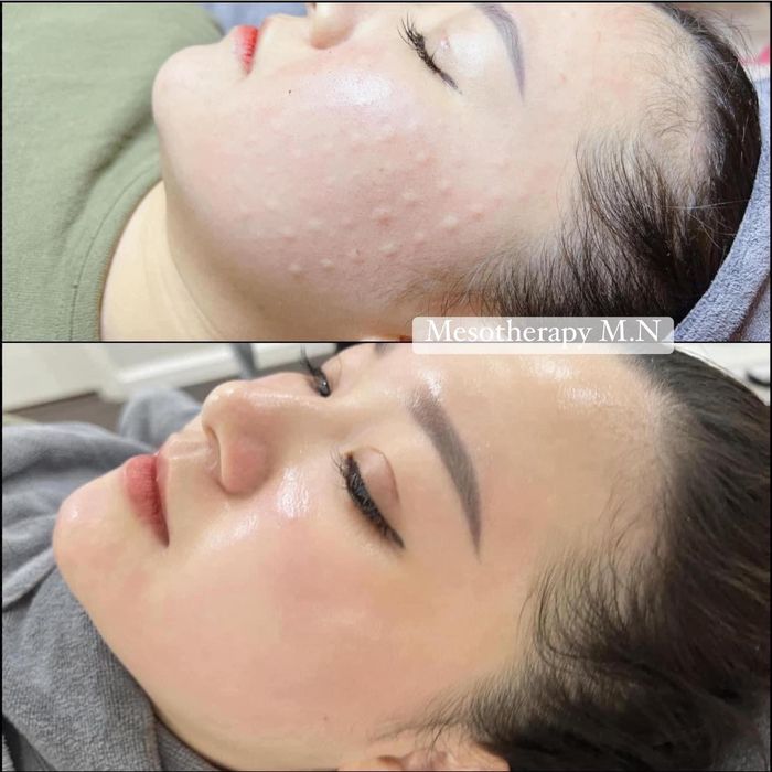 Mỹ Nguyễn Beauty – Hình ảnh không gian làm đẹp đẳng cấp (ảnh 2)