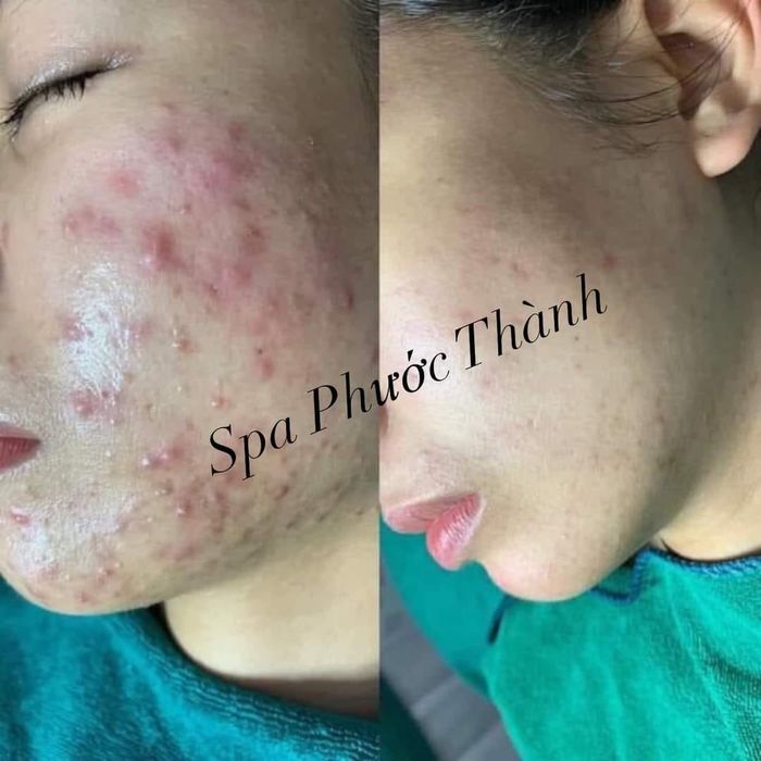 Spa Phước Thành – Hình ảnh 2