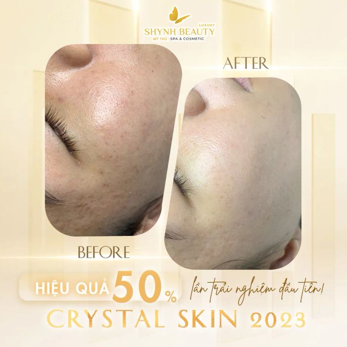 Hình ảnh liệu trình chăm sóc da cao cấp tại Shynh Beauty Spa