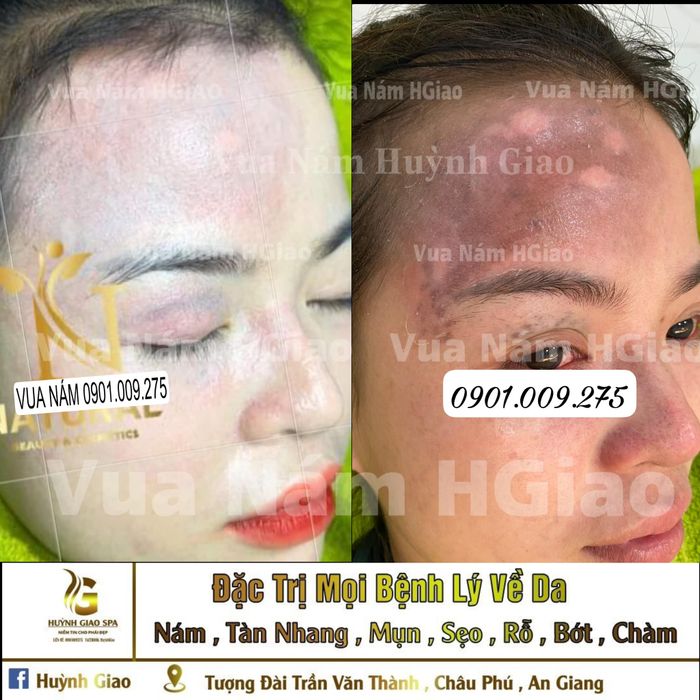 Hình ảnh trải nghiệm dịch vụ cao cấp tại Spa Huỳnh Giao