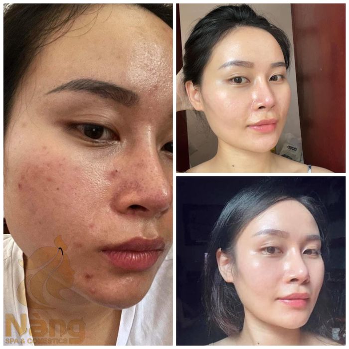 Không gian trị liệu sang trọng và chuyên nghiệp tại Nàng Spa