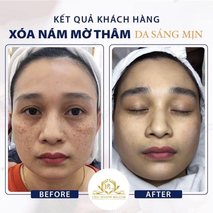 Viện Thẩm Mỹ Hoa Linh Beauty ảnh 2 - Phòng điều trị tiêu chuẩn 5 sao với hệ thống máy móc tân tiến nhất