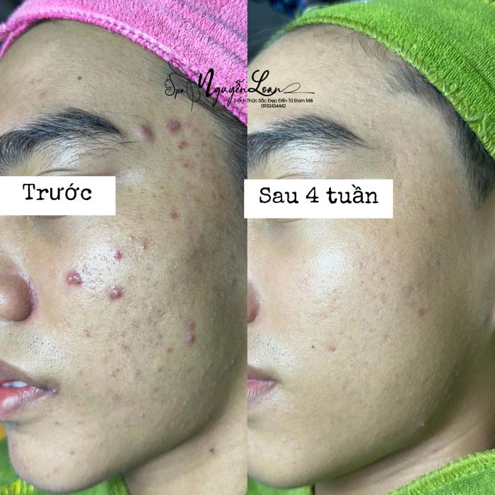 Không gian sang trọng tại Spa Nguyễn Loan - Ảnh 1