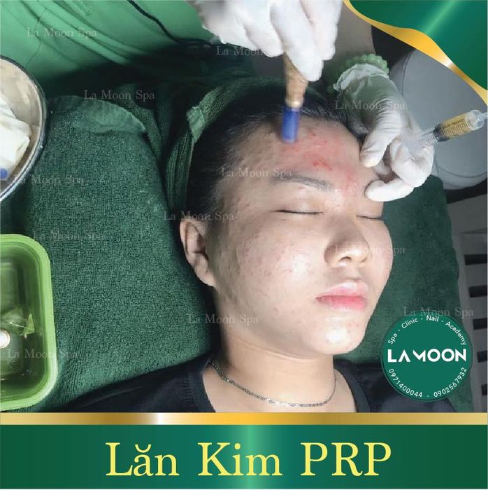 La Moon Spa - Hình ảnh thực tế về liệu trình chăm sóc da cao cấp