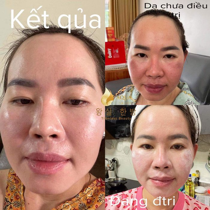 Hình ảnh liệu trình chăm sóc da cao cấp tại An Nhiên Beauty
