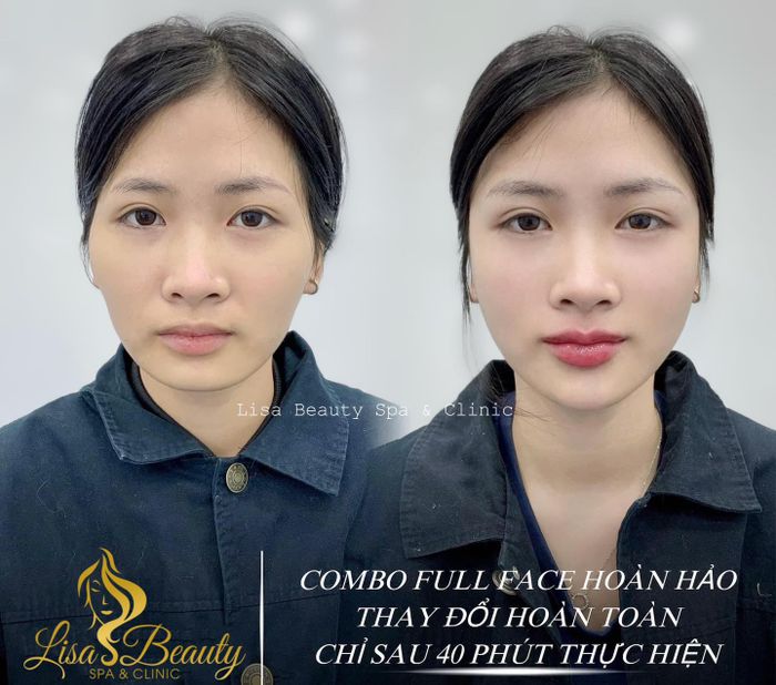 Hình ảnh quy trình chăm sóc da chuẩn y khoa tại Lisa Beauty Spa & Clinic