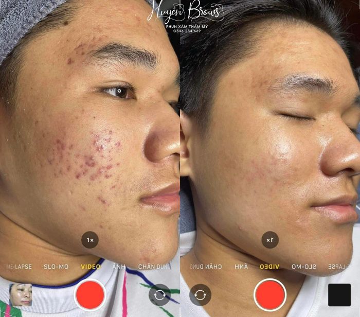 Quy trình phun xăm chuyên nghiệp tại Spa Huyền Brows - Ảnh 2