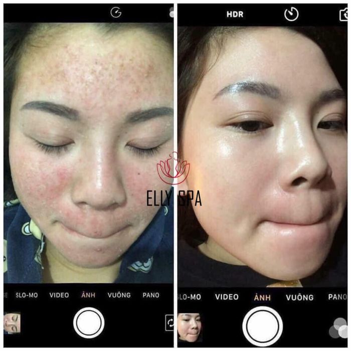 ELLY SPA - Hình ảnh 1