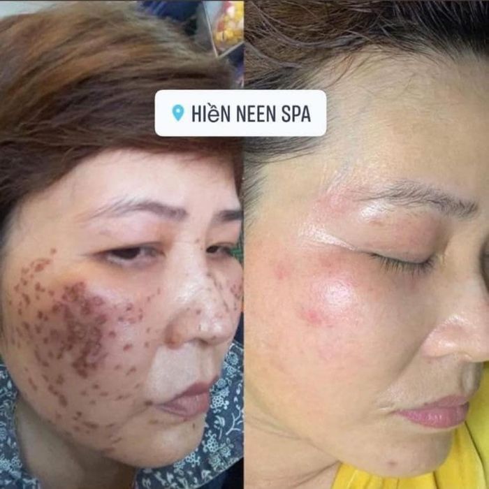 Hình ảnh tại Hiền Neen Spa