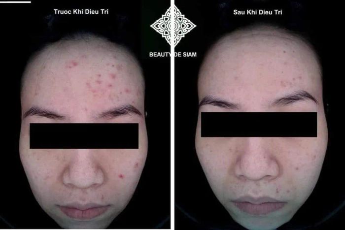 Beauty de Siam Bến Tre - Hình ảnh 1