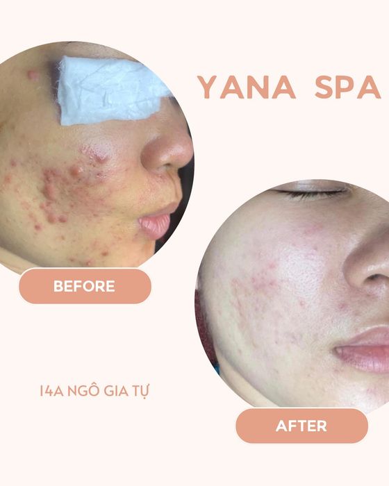 Không gian trị liệu cao cấp tại YANA Clinic & Spa