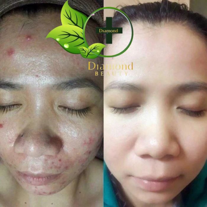 Diamond Spa & Beauty - Hình ảnh 1