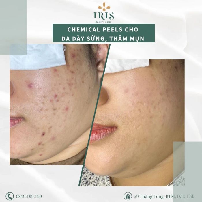 IRIS Beauty Clinic hình ảnh 2