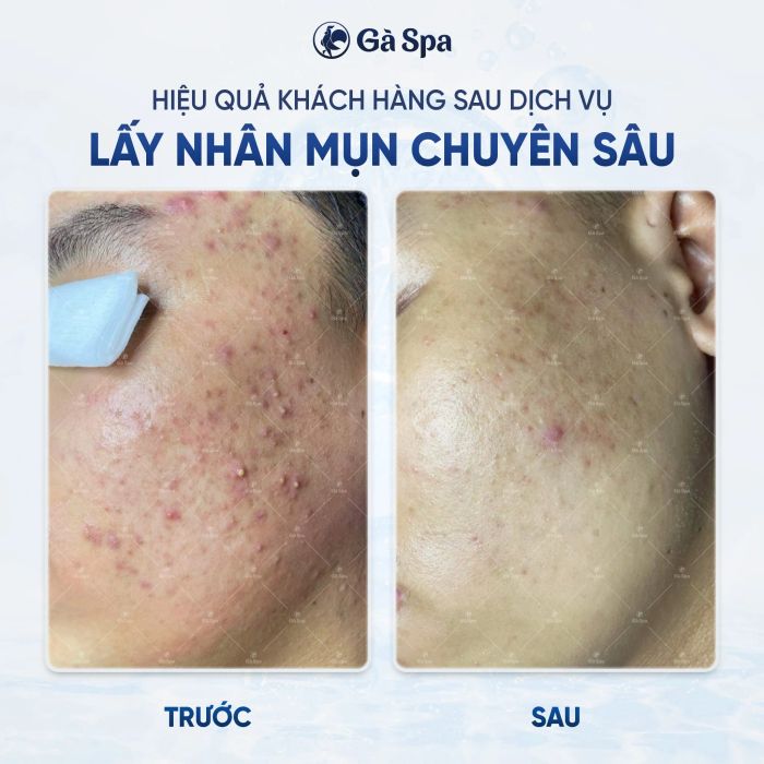Không gian trị liệu hiện đại tại Gà Spa Quy Nhơn - Ảnh 1