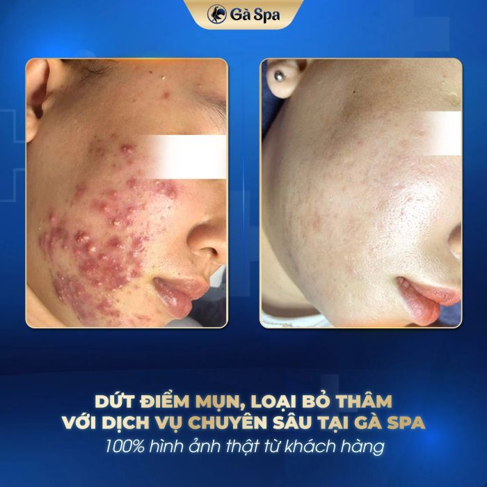 Gà Spa Buôn Ma Thuột hình ảnh 1