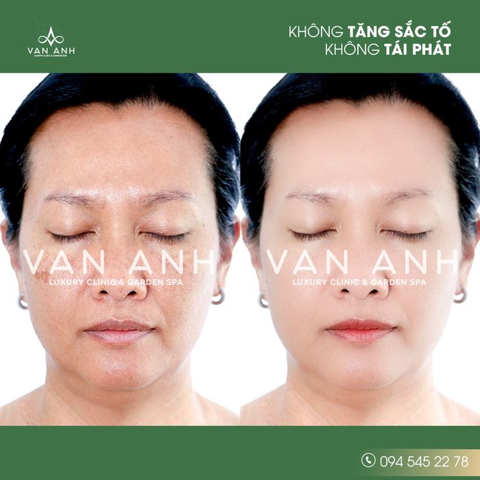 Van Anh Garden Spa - Hình ảnh 2