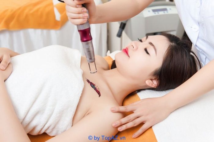Địa chỉ xóa hình xăm uy tín tại Hà Nội
