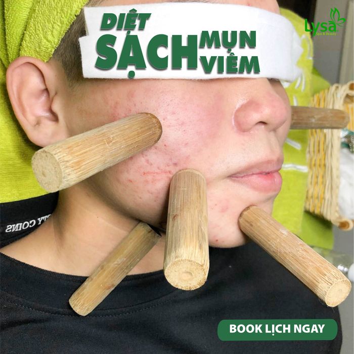 LYSA Spa & Beauty Hình Ảnh 2