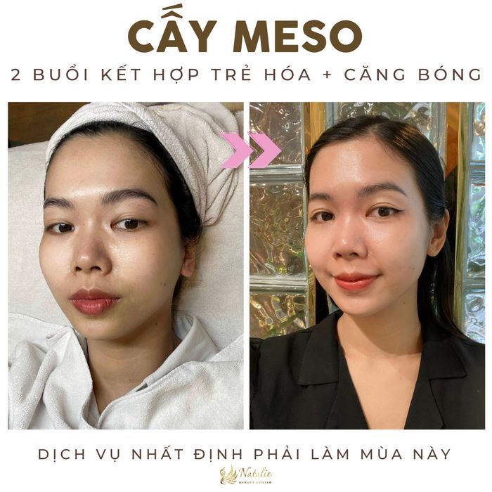 Hình ảnh Natalie Beauty Center 2