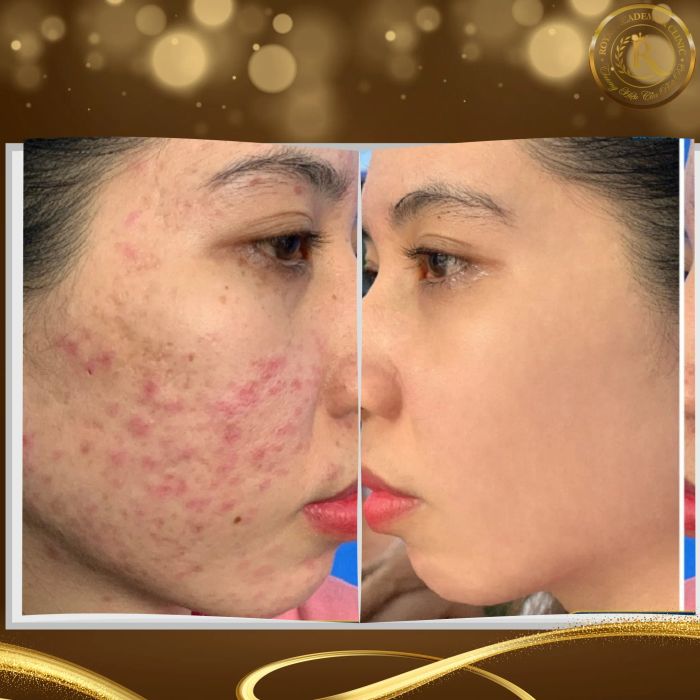 Không gian trị liệu hoàng gia tại Spa Beauty Royal - Ảnh 1