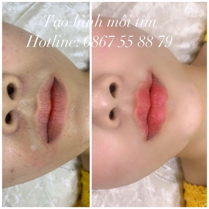 Không gian sang trọng và dịch vụ chuyên nghiệp tại Lavender Beauty Spa & Clinic