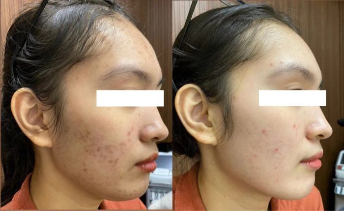 Không gian trị liệu sang trọng tại ZENN Clinic - Ảnh 1