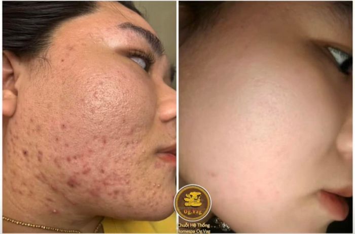 Không gian ấm cúng tại Chăm Ngọc Homespa