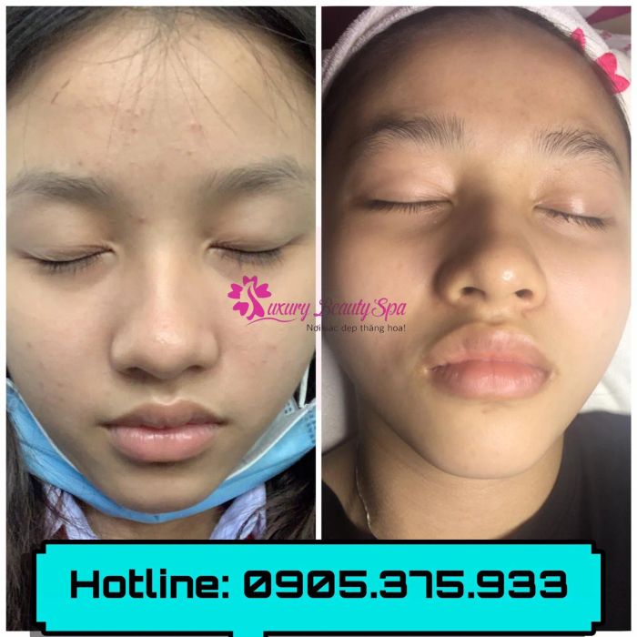 Hình ảnh không gian đẳng cấp tại Luxury Beauty Spa Quy Nhơn