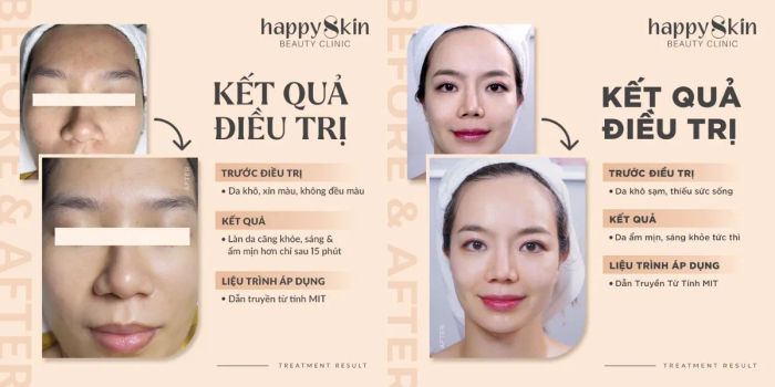 Trải nghiệm chăm sóc da chuyên nghiệp tại Happy Skin Beauty Clinic