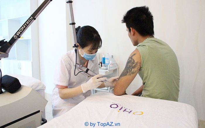 Địa chỉ xóa hình xăm uy tín tại Hà Nội