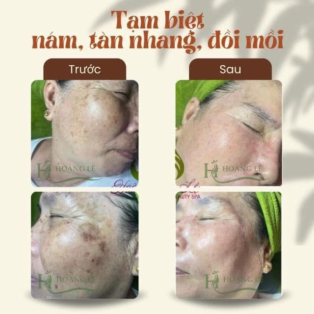 Hình ảnh không gian sang trọng tại Spa Hoàng Lệ